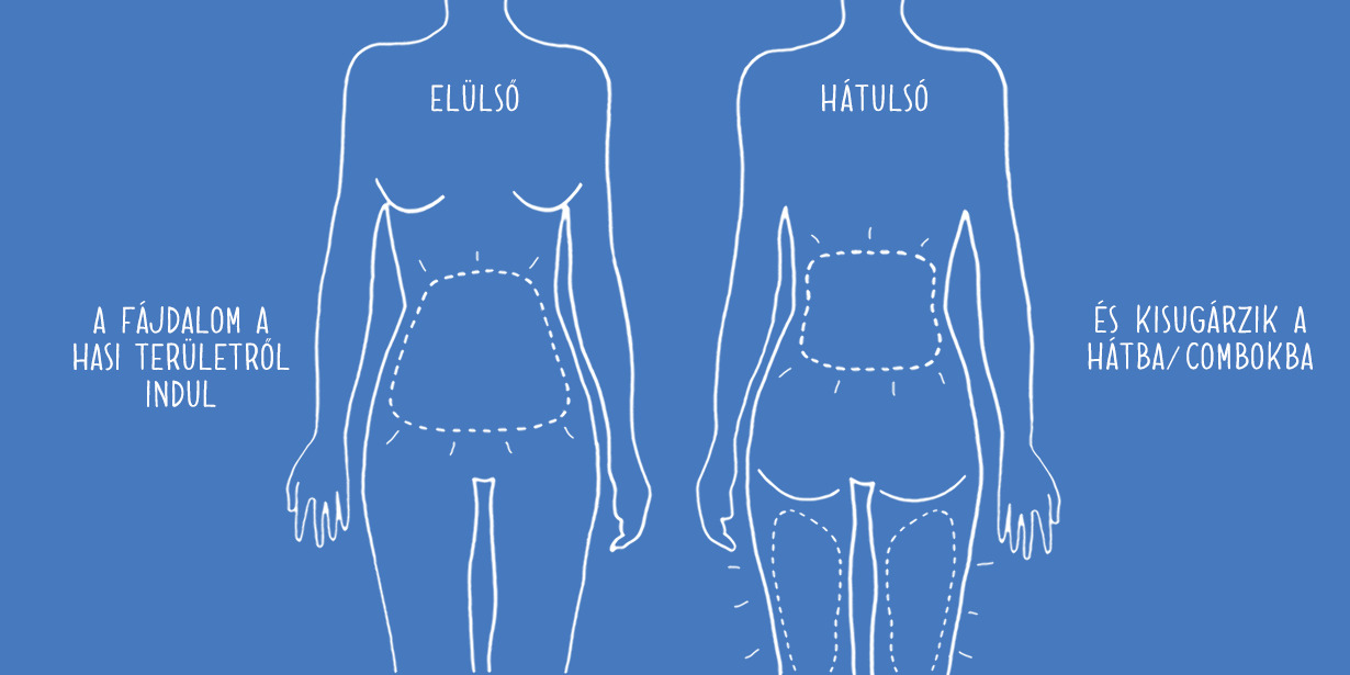 Menstruációs fájdalom